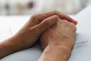 How Acupuncture Can Benefit Seniors